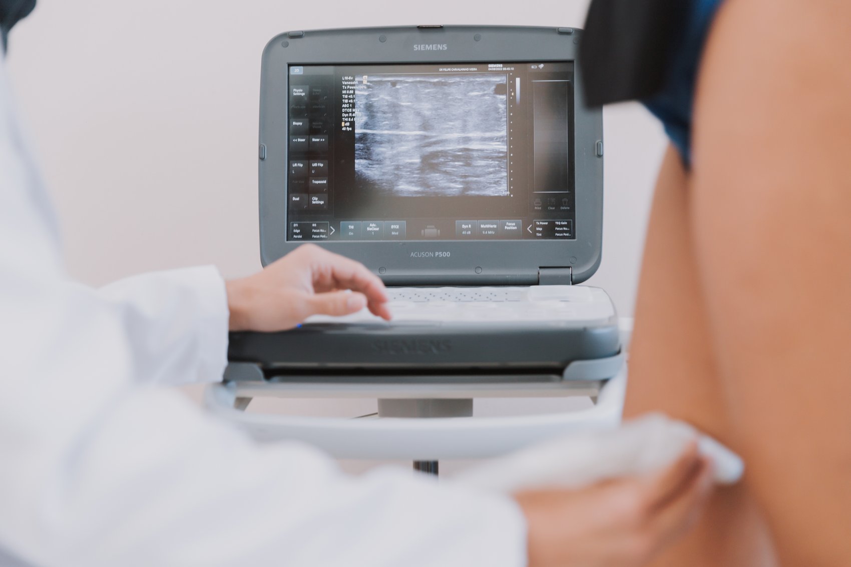 Dr. Felipe realizando ultrassom Doppler vascular das pernas